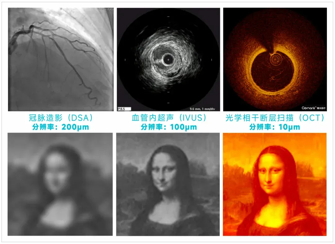 临床PK完胜ChatGPT-5！国内团队造出首个OCT影像AI系统